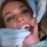 Lady receiving dental checkup