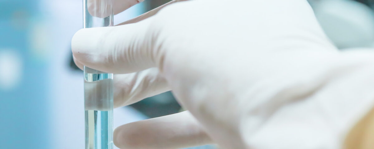 dental unit waterline testing vial