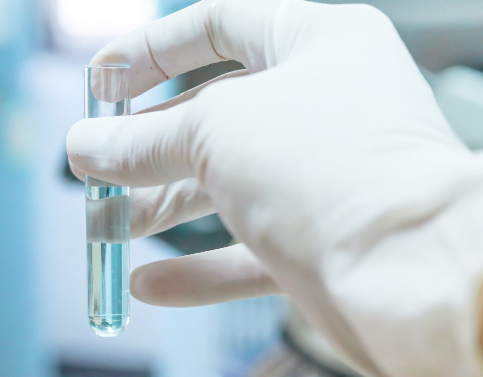 dental unit waterline testing vial